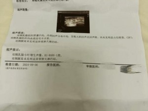 佳柔和医院长第2次手术详细介绍-佳柔和医院长第 2 次手术详细介绍