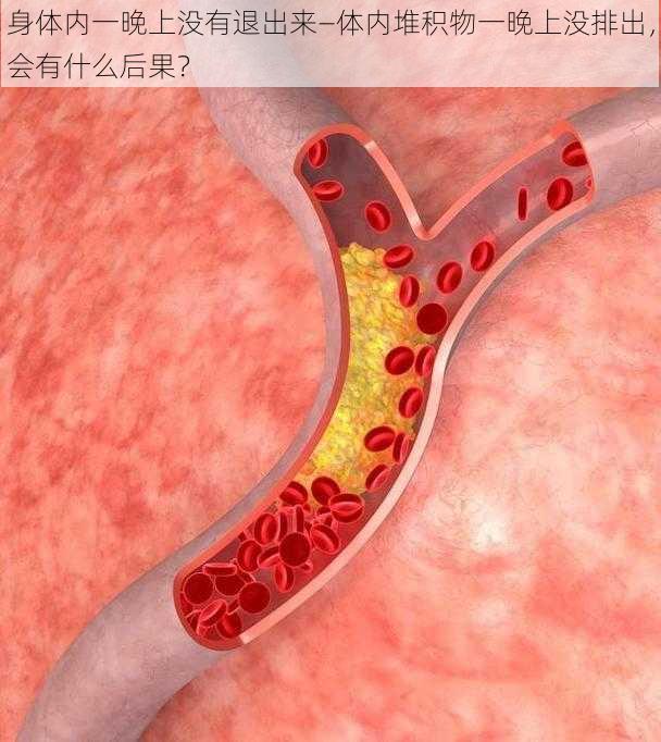 身体内一晚上没有退出来—体内堆积物一晚上没排出，会有什么后果？