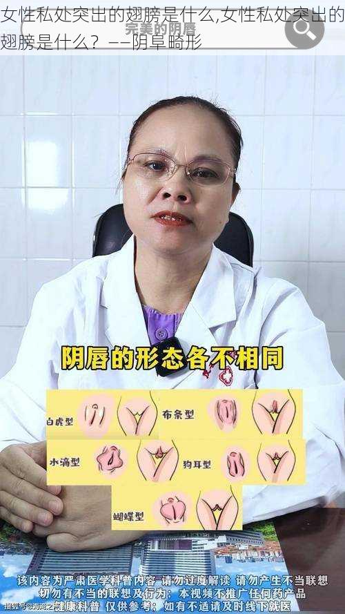 女性私处突出的翅膀是什么,女性私处突出的翅膀是什么？——阴阜畸形